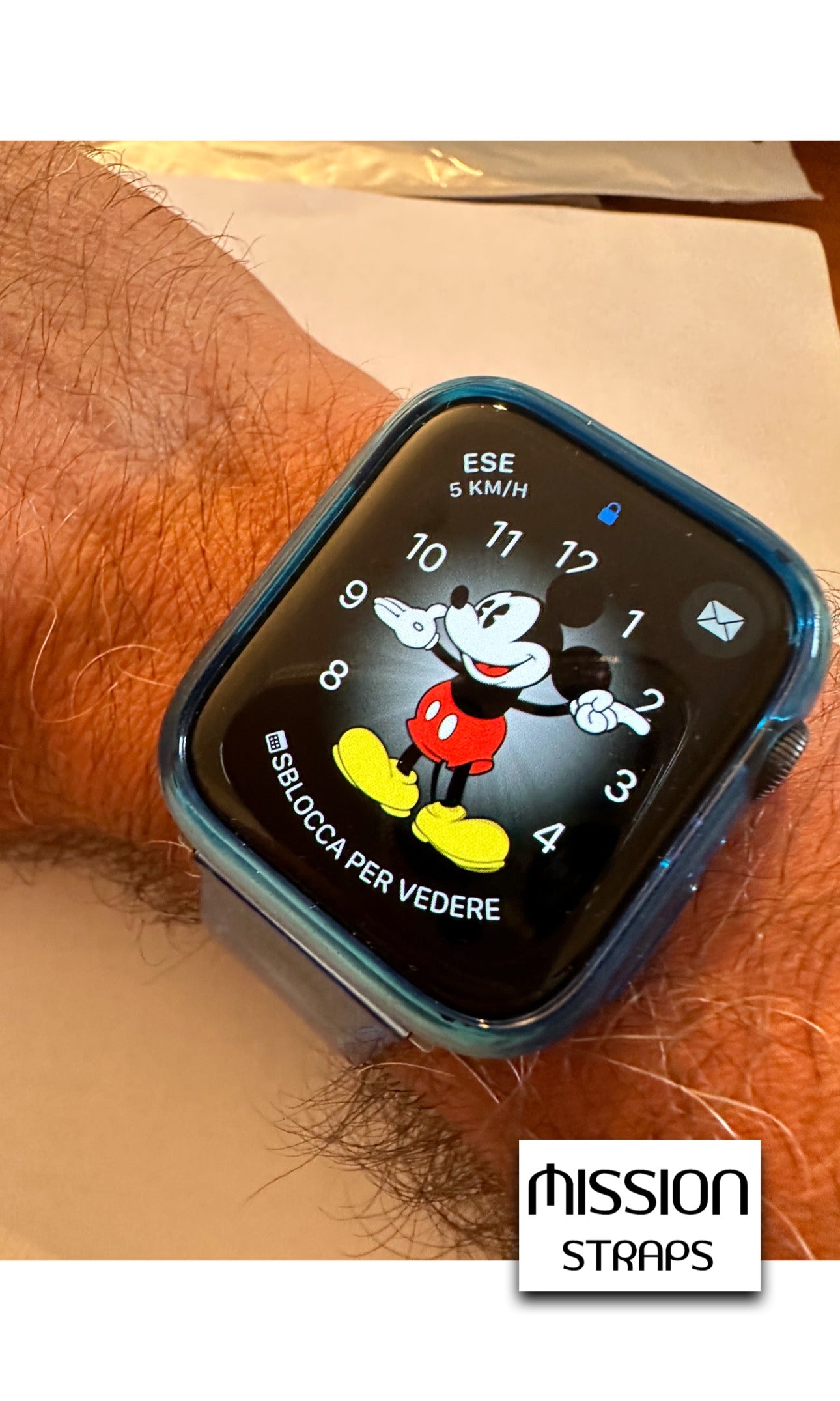 Cinturini + Copri Cassa GOMMY x orologi Apple Watch IWatch
