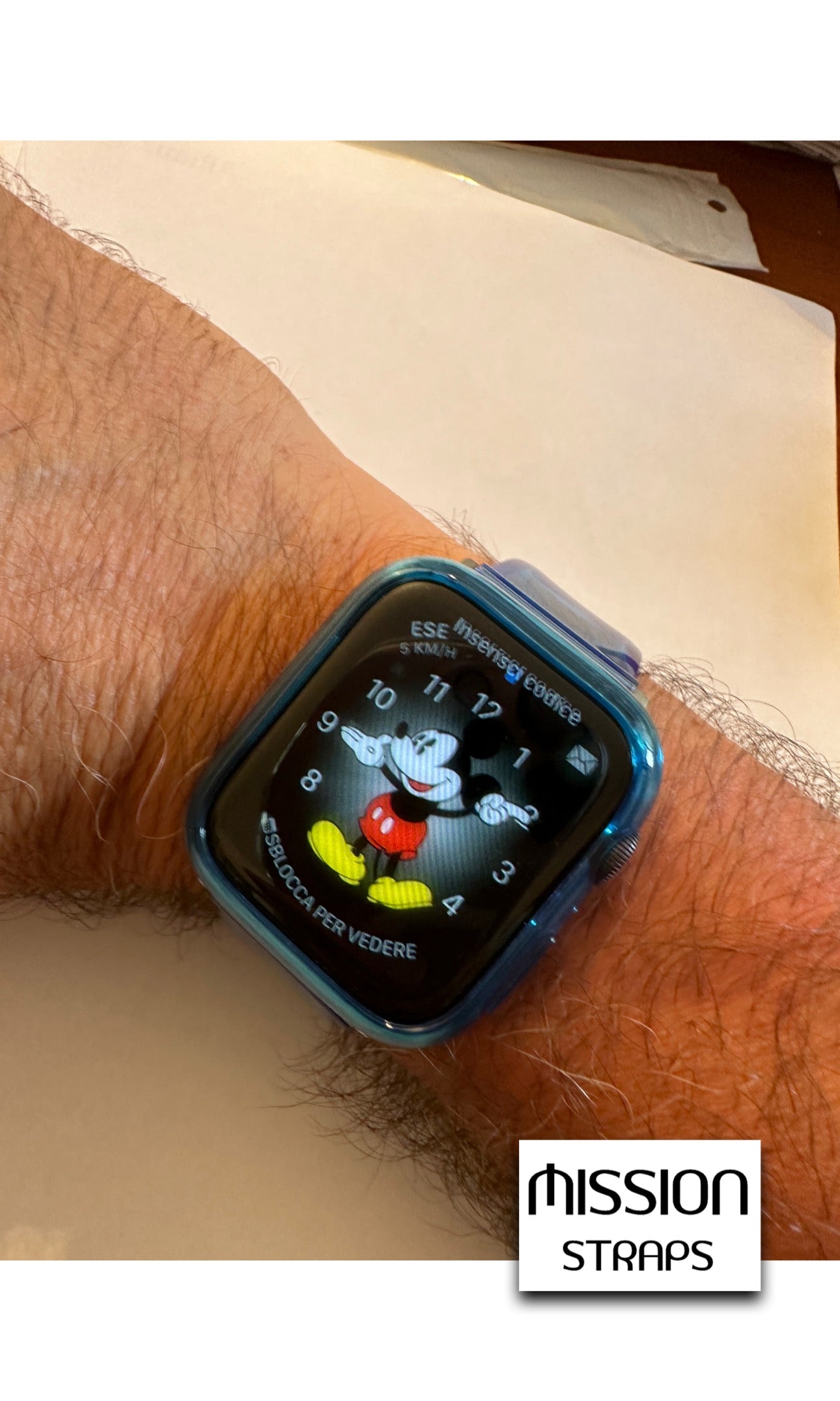 Cinturini + Copri Cassa GOMMY x orologi Apple Watch IWatch