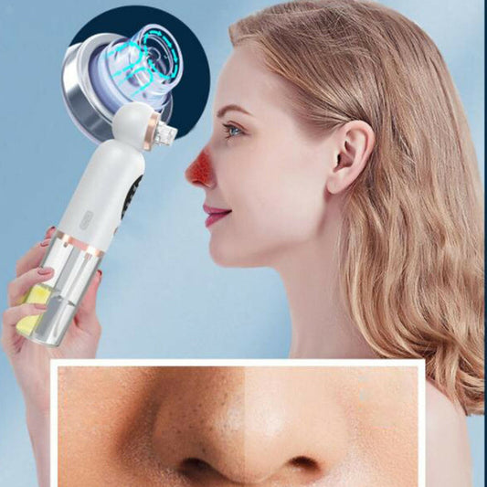 Vacuum cleaner for blackhead removal - Facial cleansing using a hydroaspirator